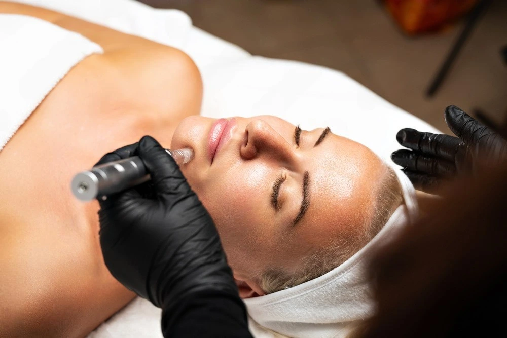 Top Benefits of RF Microneedling for Aging Skin